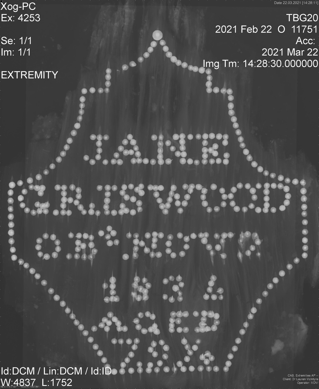X-ray of the studded coffin lid of Jane Griswood